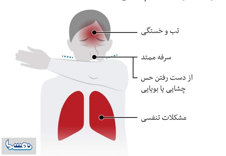 چه سرفه‌ای نشانه کروناست؟