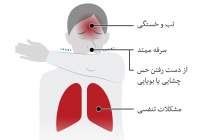 چه سرفه‌ای نشانه کروناست؟